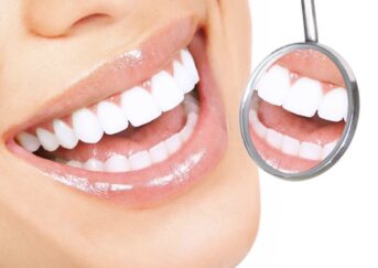 White Teeth and Healthy Gums